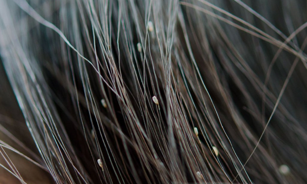 How to check for nits