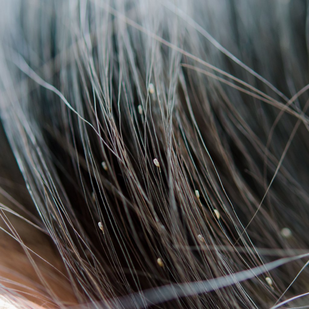 How to check for nits