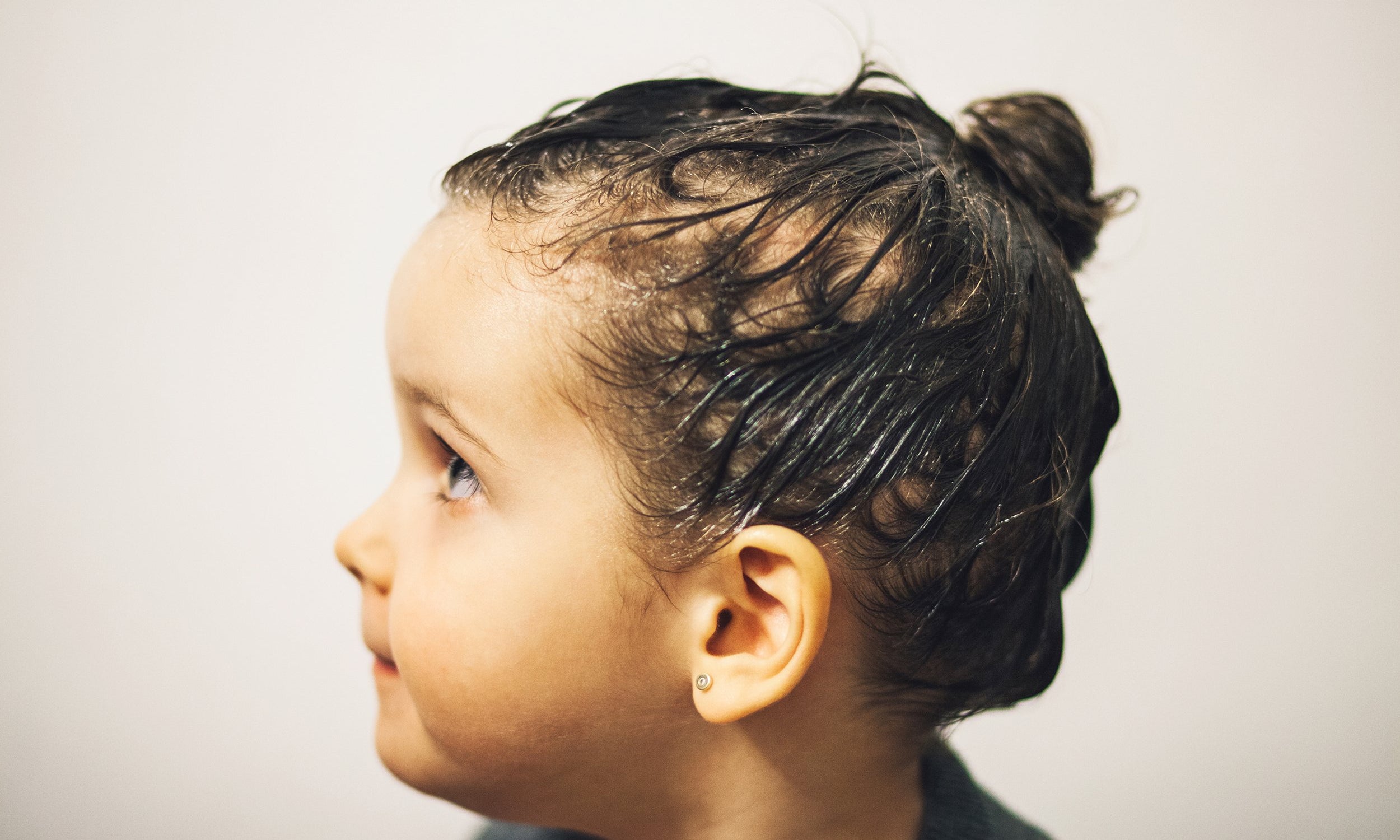 What is the best treatment for lice?