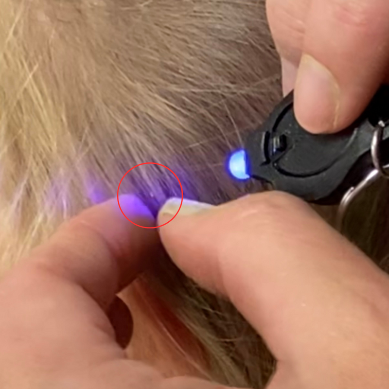 Right next to the scalp