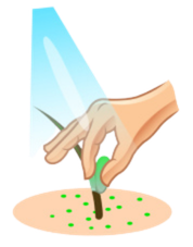 Nit picking — combing out glowing nits